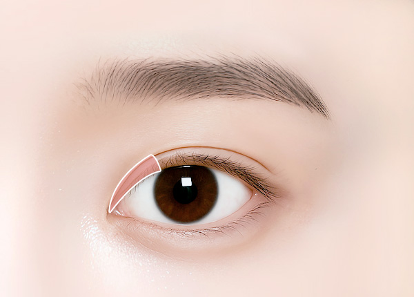 윗트임