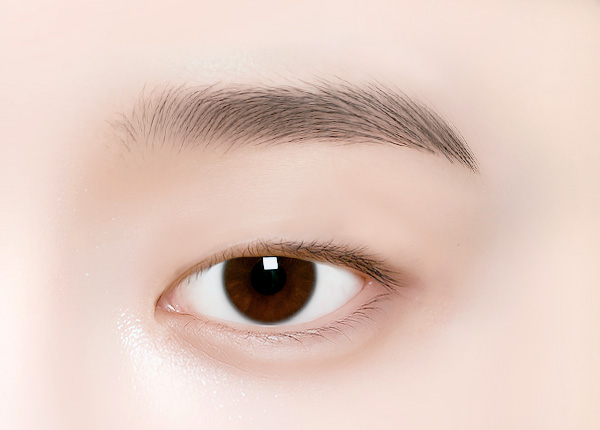 안검하수가 있는 눈