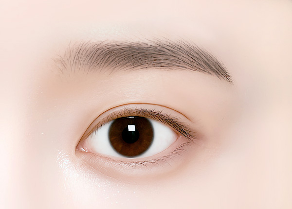 리얼리 눈매교정 후