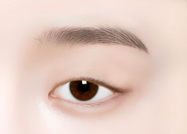 노화로 인한 눈꺼풀 처짐이나 무거운 눈