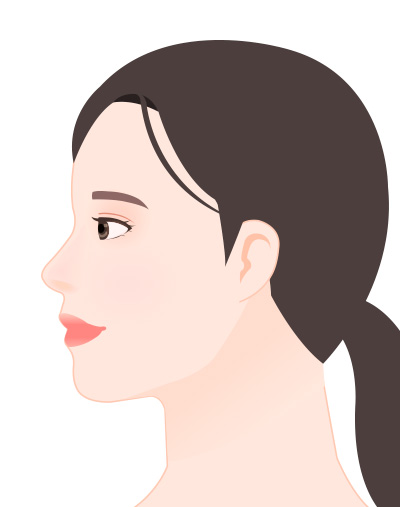 첨부사진 예시 - 측면