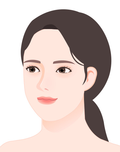 첨부사진 예시 - 45도