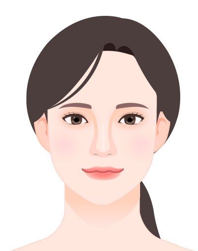 첨부사진 예시 - 정면
