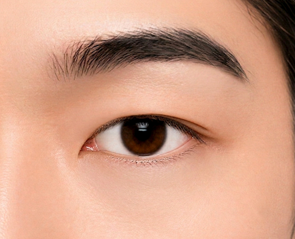 남자눈_술후