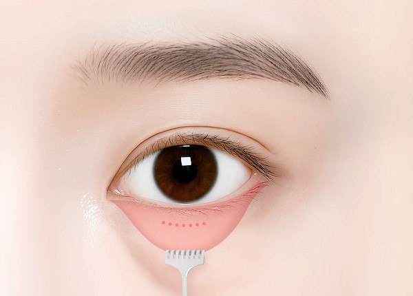Close-up of a brown eye with a pink under-eye gel patch and a small applicator applying it below the eye momentarily visible on the skin.
