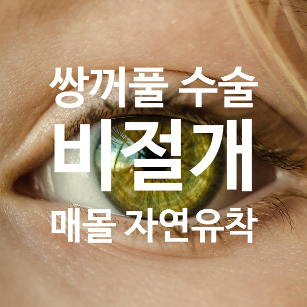 근접 눈 클로즈업에 흰색 한글 텍스트가 겹쳐 있음: '쌍꺼풀 수술 비절개 매몰 자연유착'