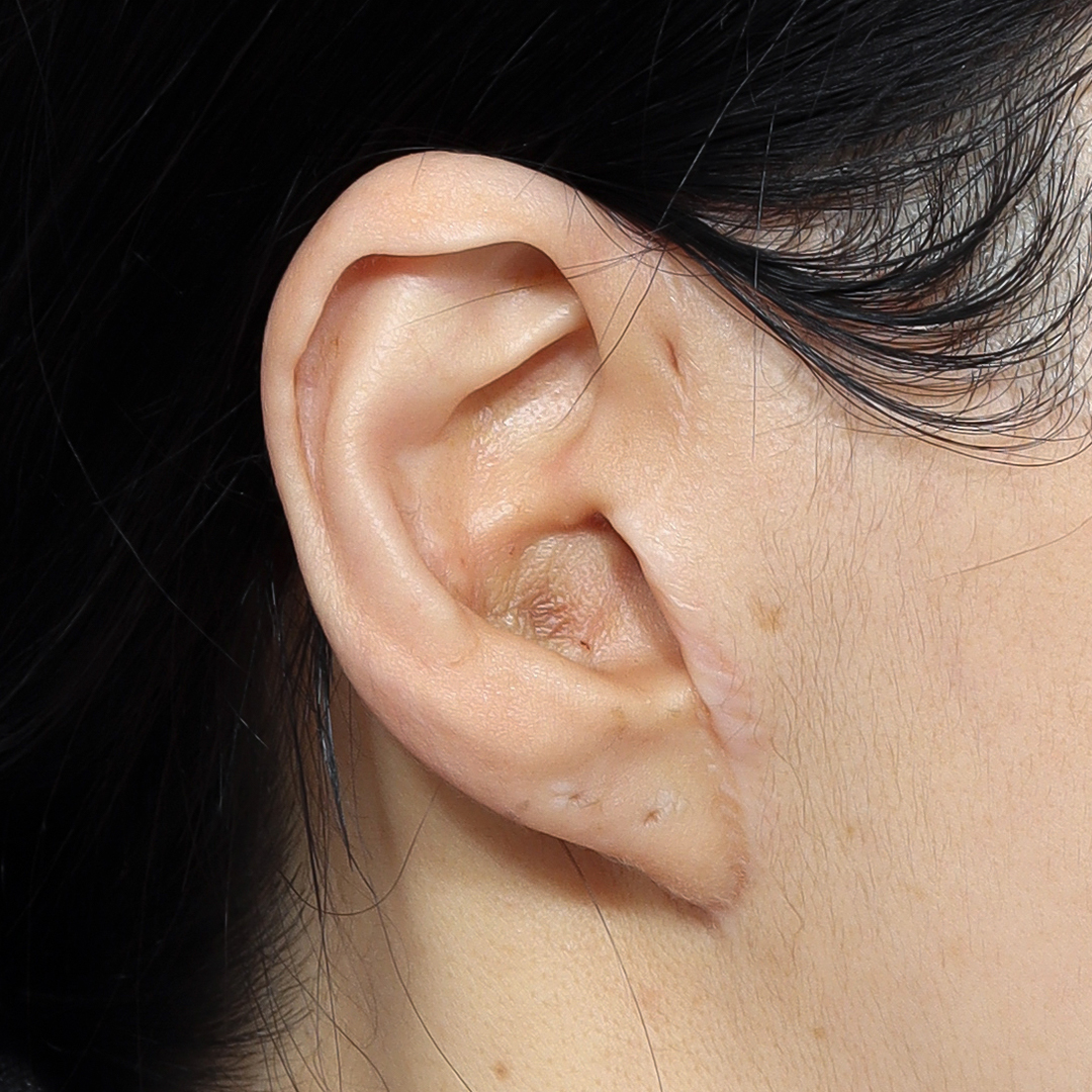 Close-up of a human ear from the side with light skin and dark hair framing the ear surface