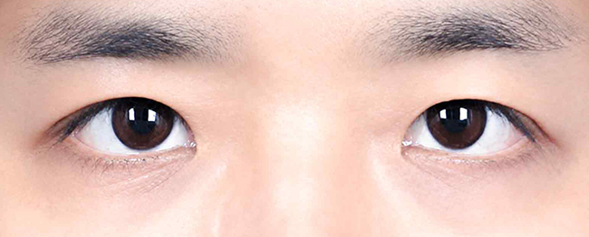 Close-up of a person’s eyes looking straight ahead, showing dark irises and well-defined eyebrows.