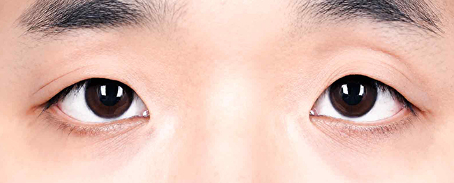 Close-up of a person’s eyes looking forward, showing dark irises and smooth skin around them