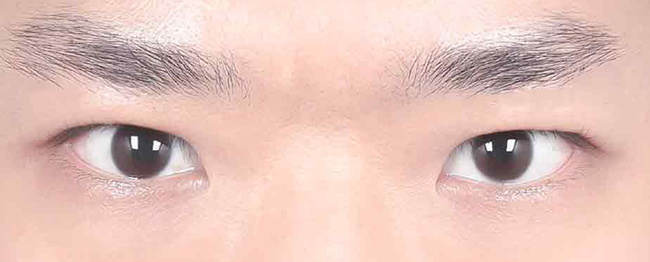 Close-up of a person's eyes and eyebrows looking forward.