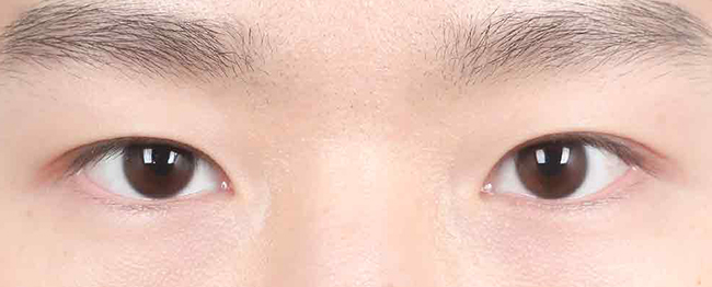Close-up of a person's eyes looking straight ahead, showing dark brown irises and well-defined eyebrows beneath.
