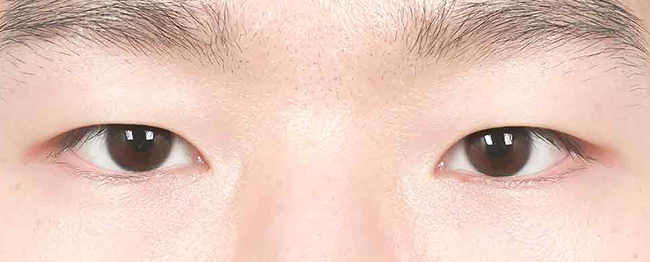 Close-up of a person’s eyes and eyebrows, looking forward.