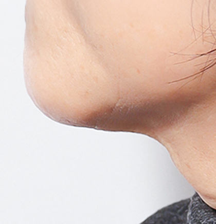 Close-up of a person's chin and lower jawline with smooth skin texture.