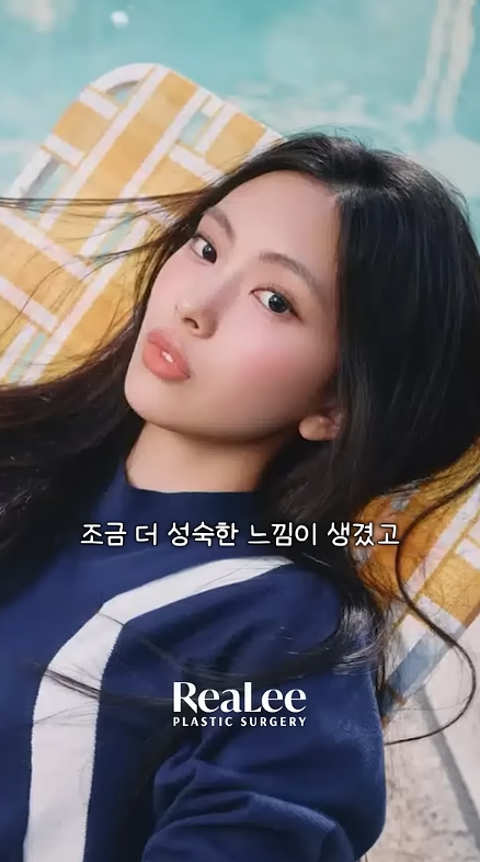 Portrait of a young woman resting on a striped lounge chair by a pool, with Korean caption text and a RealLee Plastic Surgery logo at the bottom.